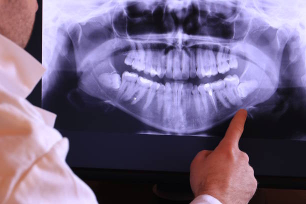 Best Emergency Root Canal Treatment in New Castle, PA