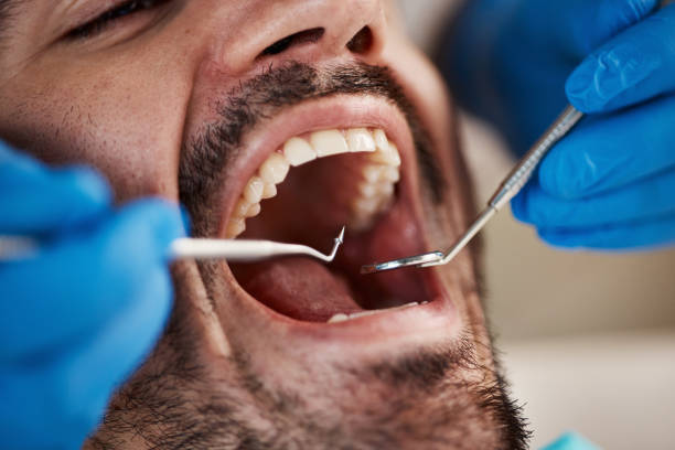 Best Walk-In Emergency Dentist in New Castle, PA